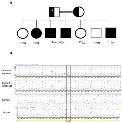 Case report: Familial hypoparathyroidism with elevated parathyroid hormone due to an inactivating PTH mutation